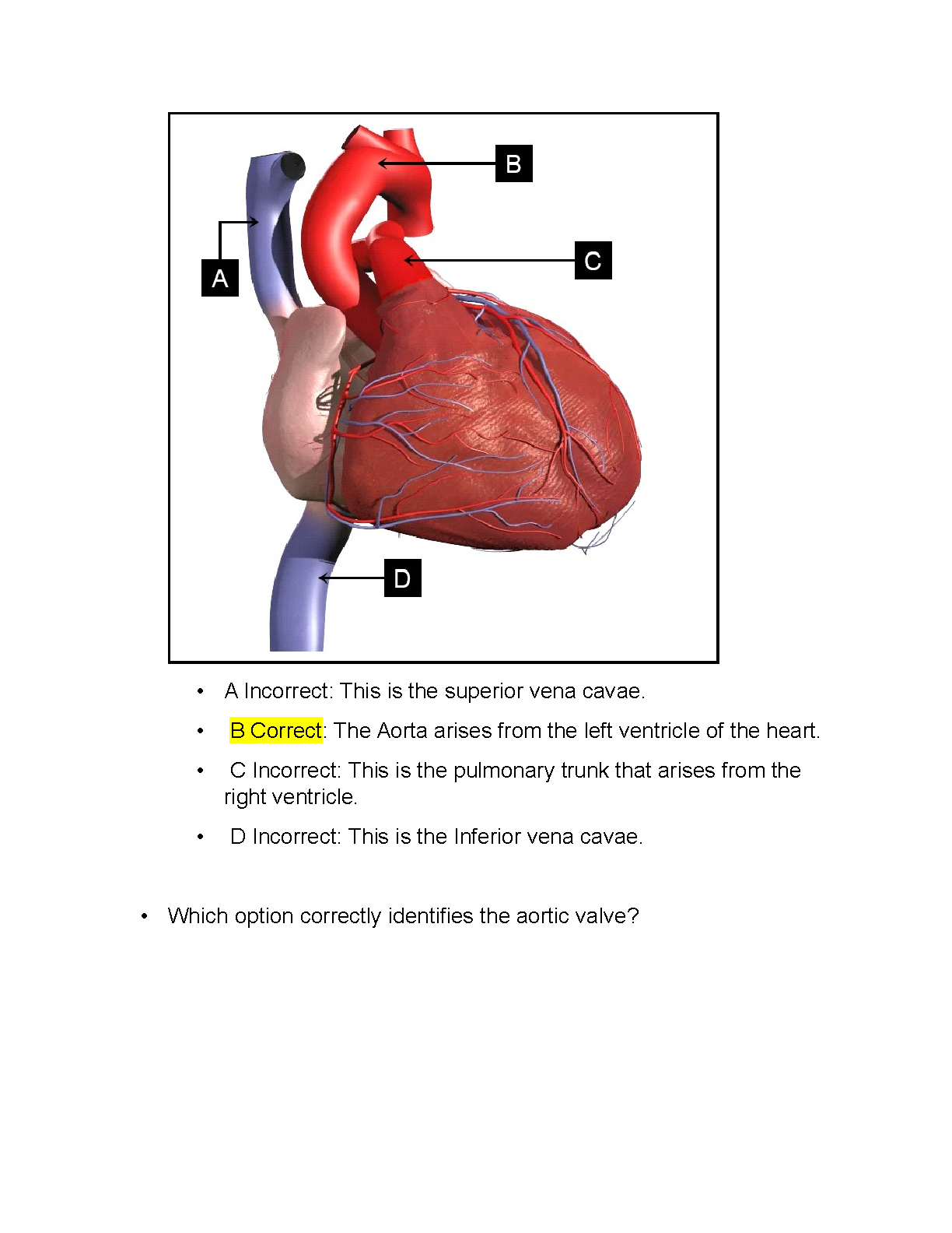 WGU D313 Heart Cardiovascular Lab Questions Explained IMG-3