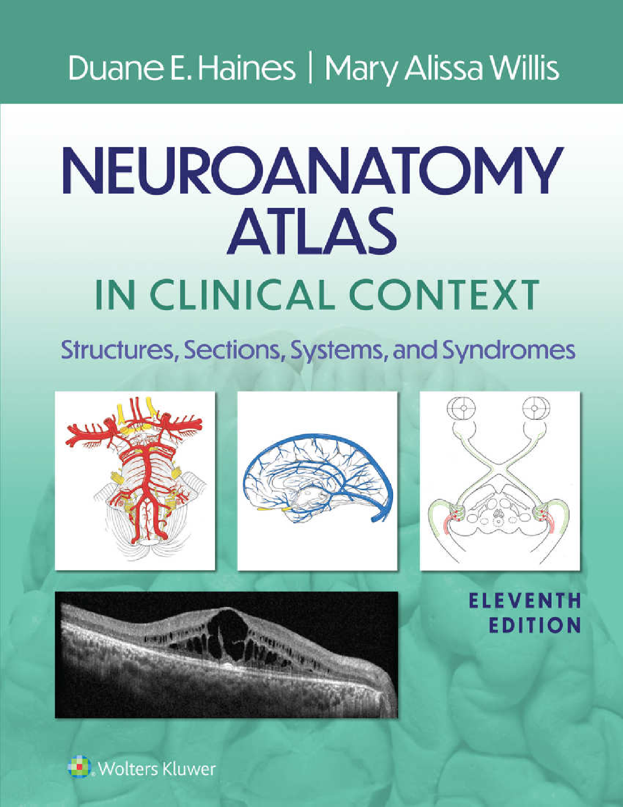 Haines Neuroanatomy 11e Test Bank and Solutions IMG-1