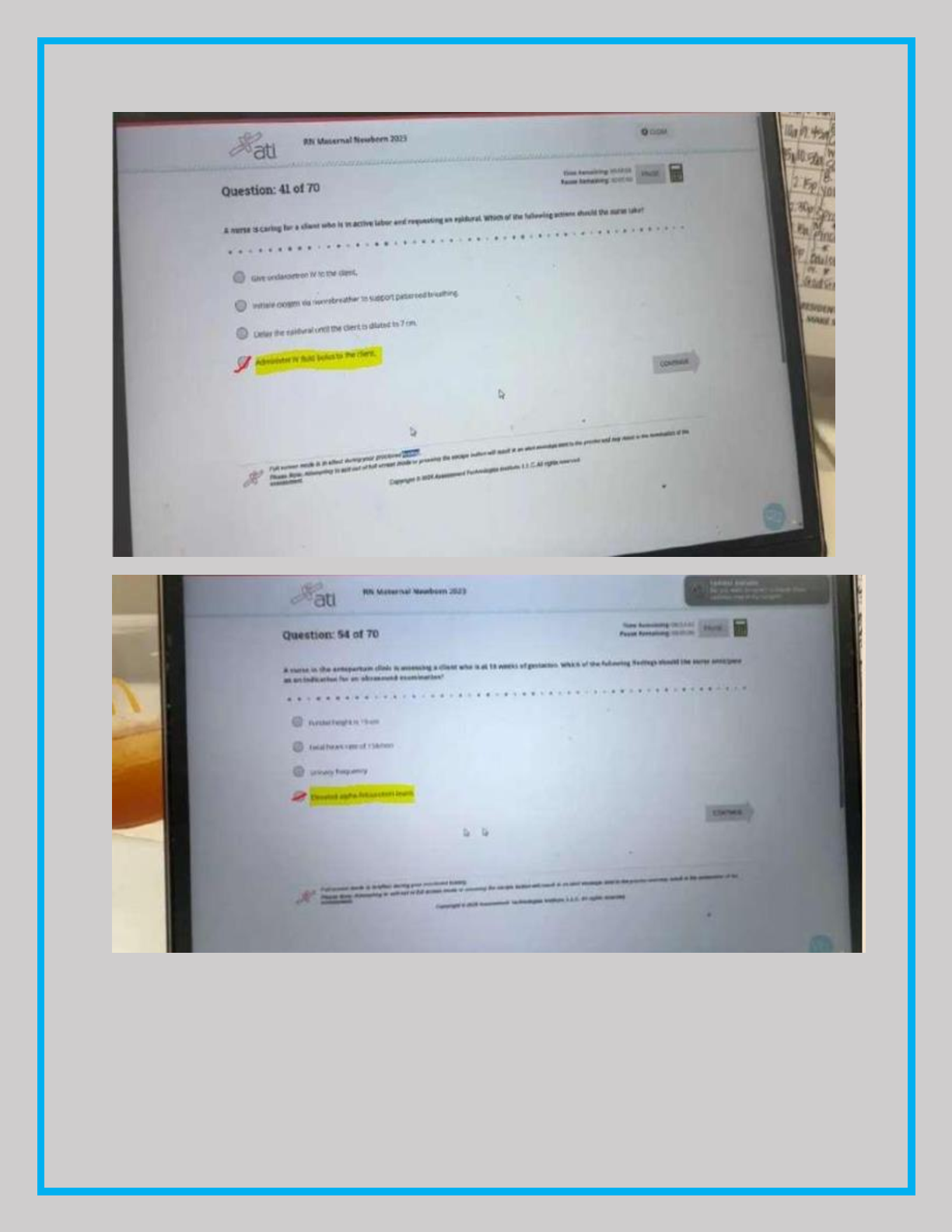ATi Maternal Newborn NGN 2026 Test Bank Questions & Answers