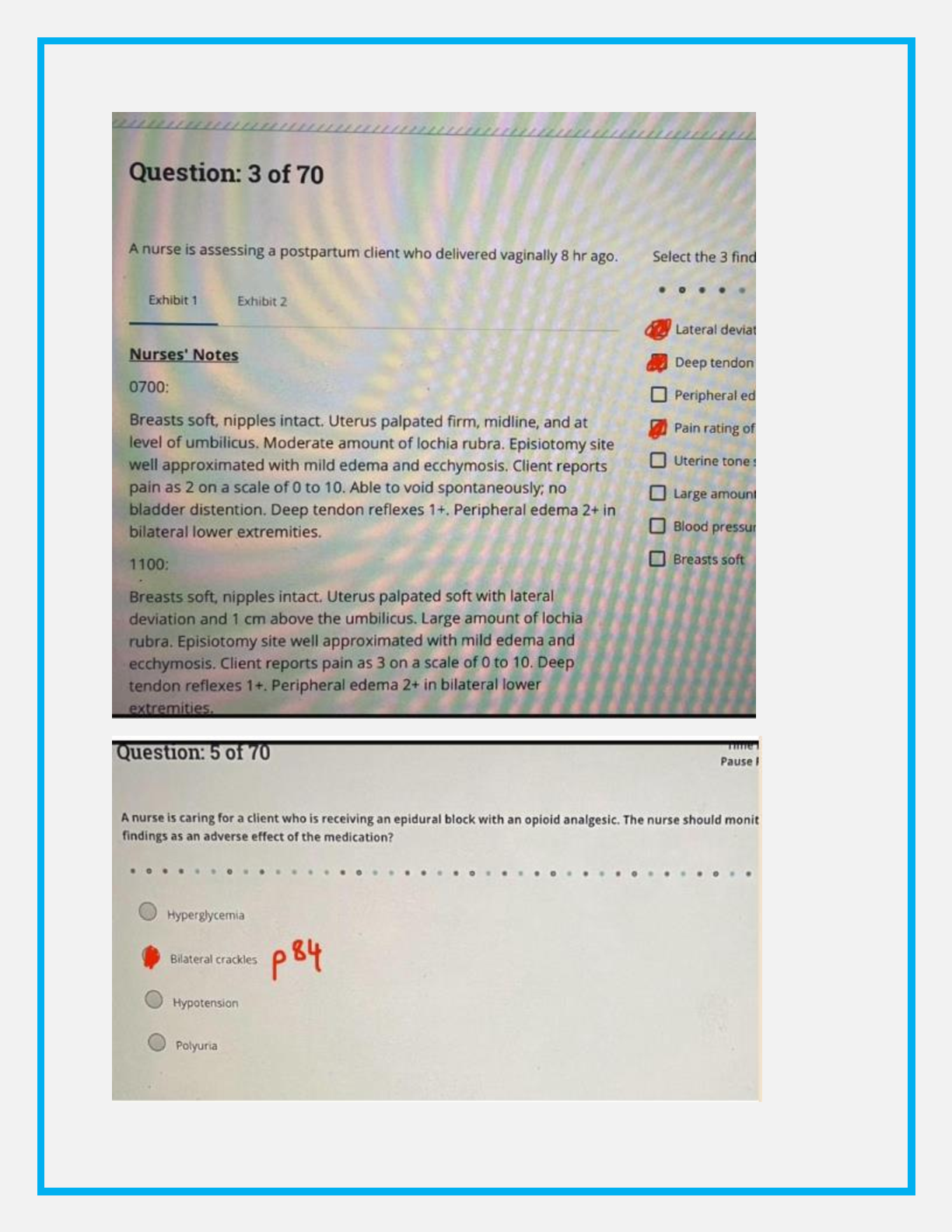 ATI RN Mat-Newborn NGN Exam Prep Guide IMG-3
