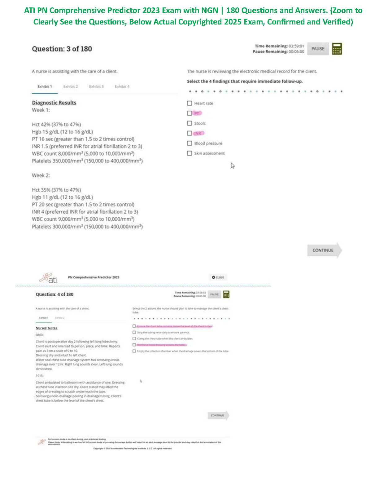 ATI PN Predictor 2026/27 Study Guide with 180 NGN Questions