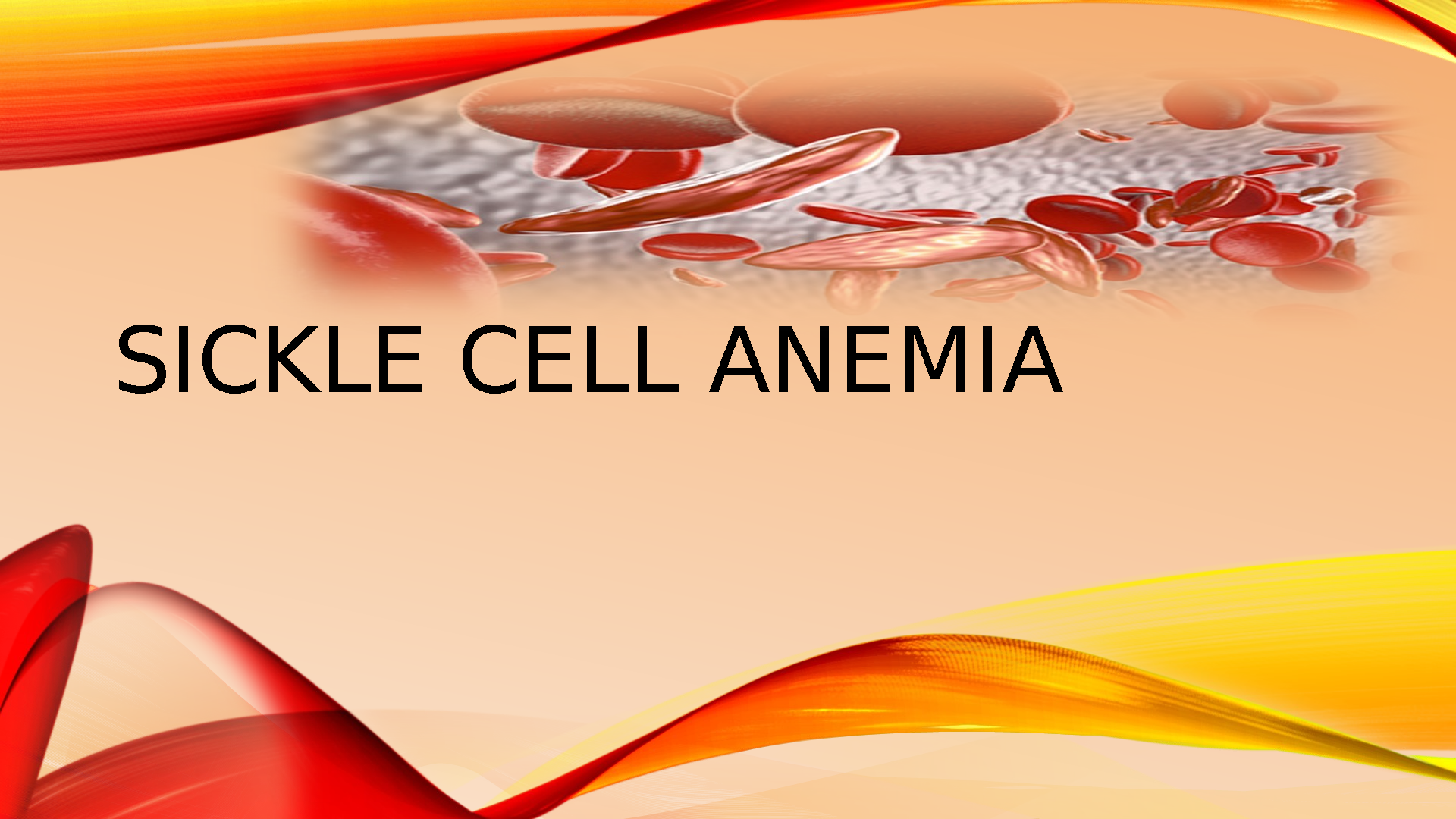 GCU NRS-434V Sickle Cell Case Study 2025/2026